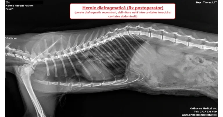 ruptura diafragmatica