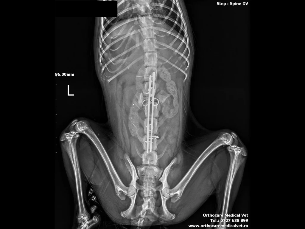 fractura coloana vertebrala caine