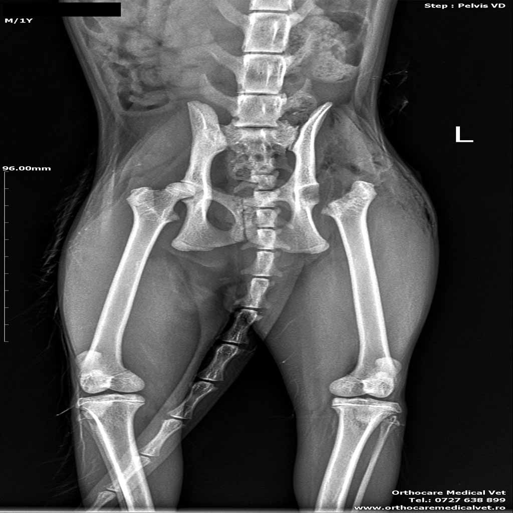 Fractura gat femural