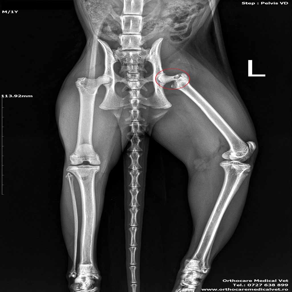 Fractura col femural