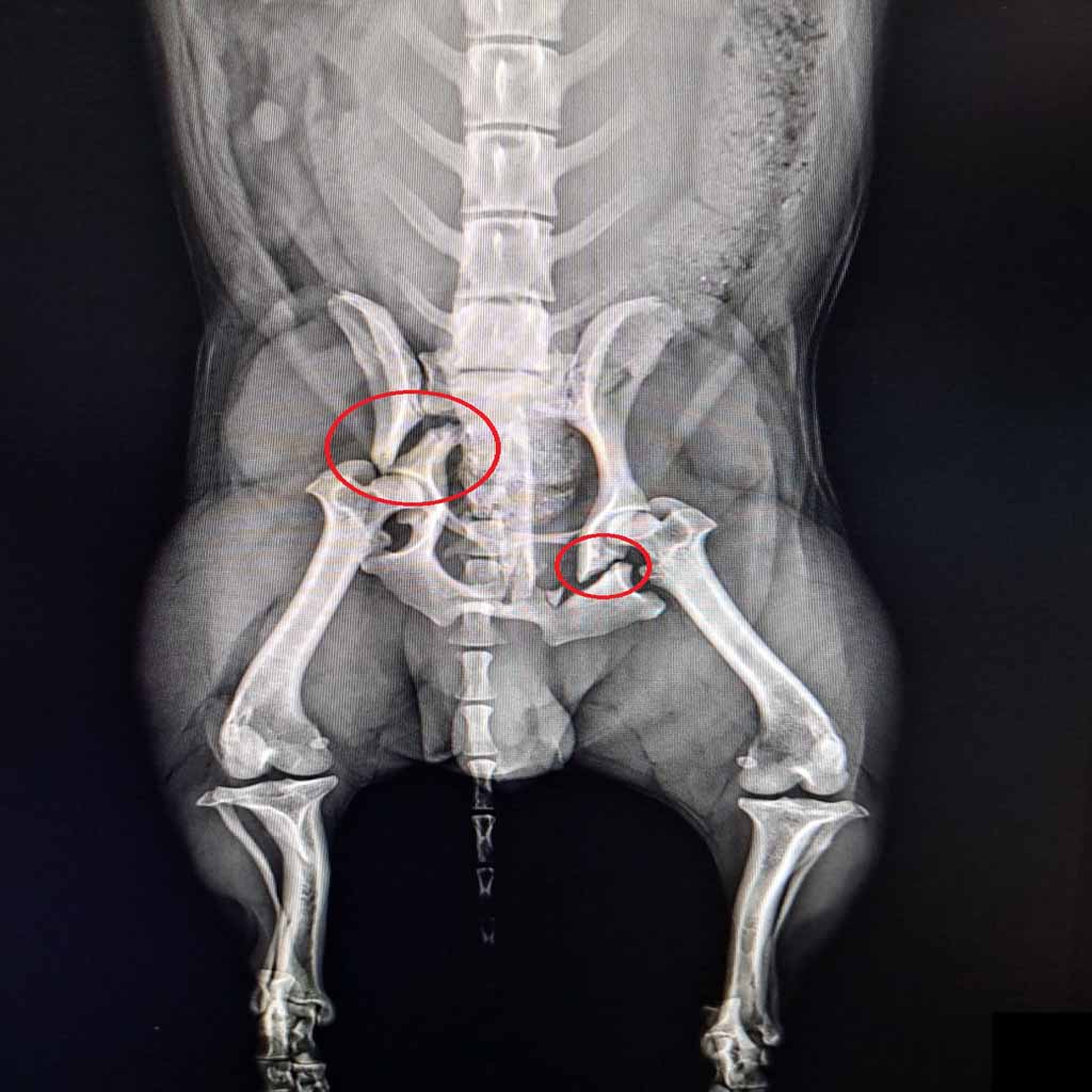 Fractura bazin caine